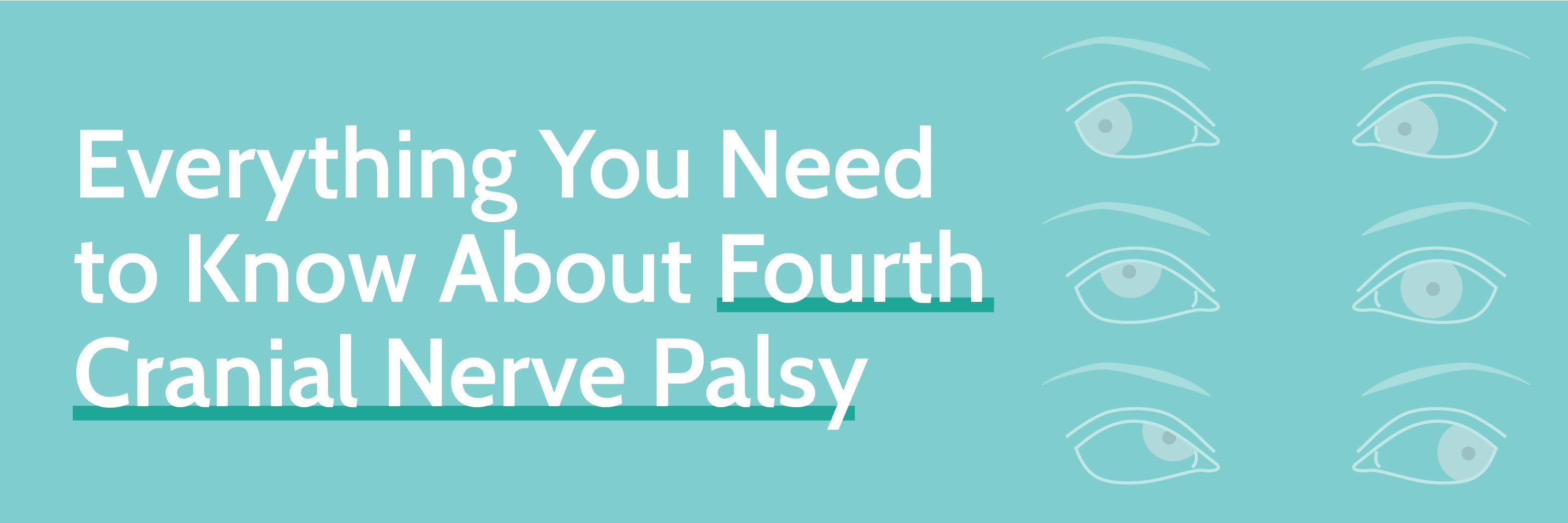 everything-you-need-to-know-about-fourth-cranial-nerve-palsy